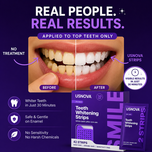 Lumé Blue-Light Whitening Strips